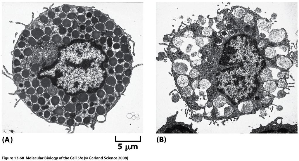 Electron micrographs of exocytosis in rat mast cells Massive