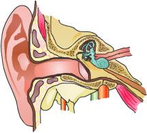 Otitis Media Introduction Otitis media is a middle ear infection. 75% of all children experience at least one episode of otitis media before they turn 3 years old.