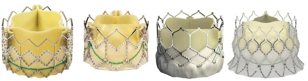 Sapien Valve: Past, Present, and Future A look at how the Sapien family of valves continues to evolve to treat a range of patients seeking transcatheter aortic valve replacement.