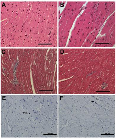 Supplemental Figure 2 Representative histology of age matched WT and RyR2-S2808D +/+ littermates.