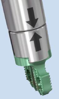 Controlled and light hammering on the Implant Holder cap may be required to advance the implant into the facet joint.