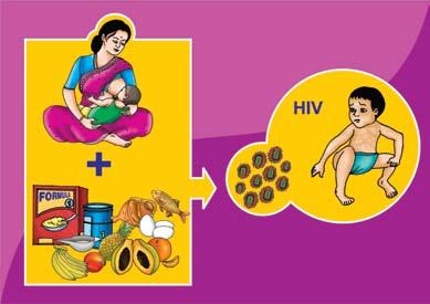 The risk of MIXED feeding on HIV infection of the baby. If you breast-feed and also give your baby other foods AT THE SAME TIME, then this is called MIXED feeding.