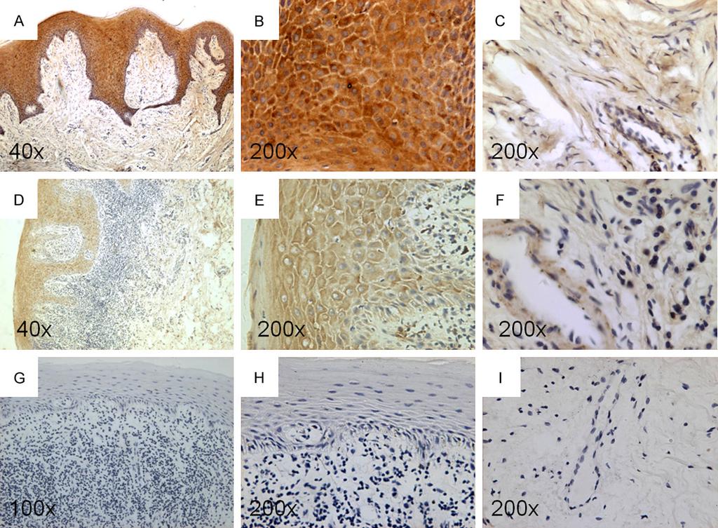 Figure 1. Typical images of immunohistochemical staining of KGF protein.