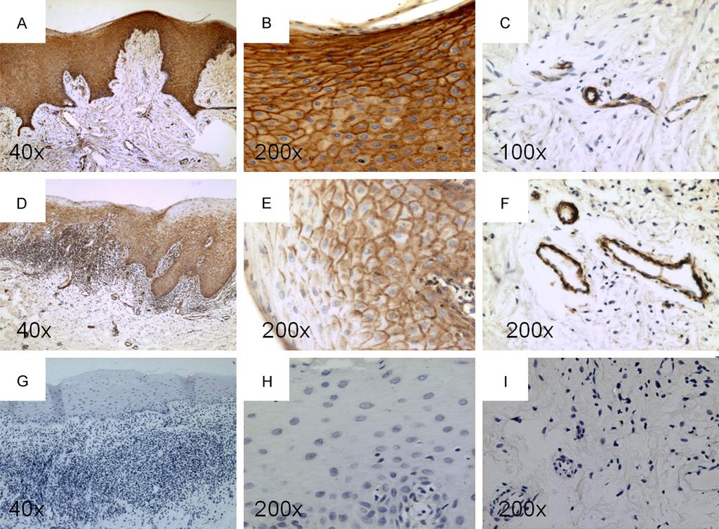 Figure 3. Typical images of immunohistochemical staining of KGFR protein.