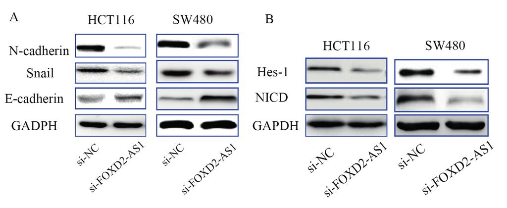 X. Yang, B. Duan, X. Zhou Figure 4. Effect of FOXD2-AS on the EMT and Notch pathway.