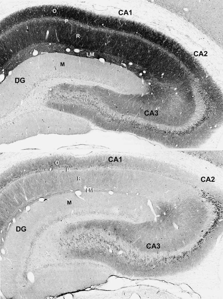 Expression of the 5 subunit is decreased in CA1 in chronic