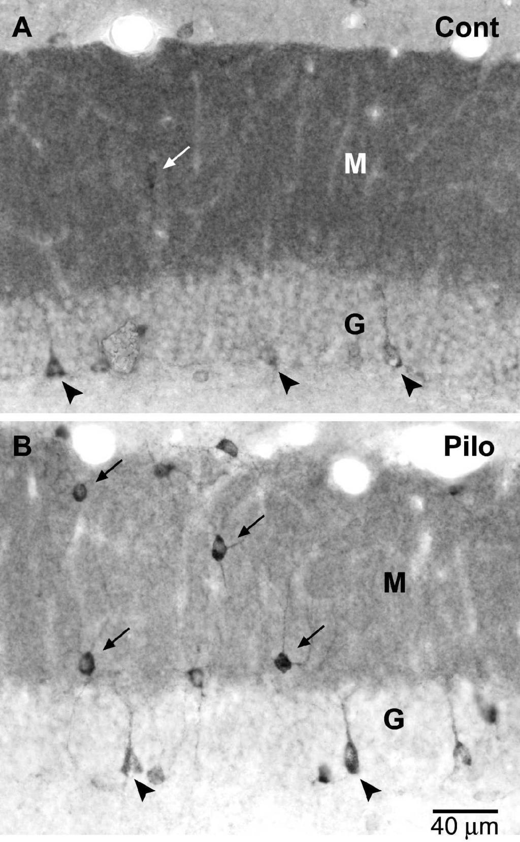 subunit labeling is increased in interneurons of the dentate gyrus in