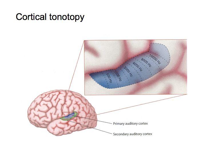Auditory cortex Auditory cortex consists of multiple areas and maintains a tonotopic
