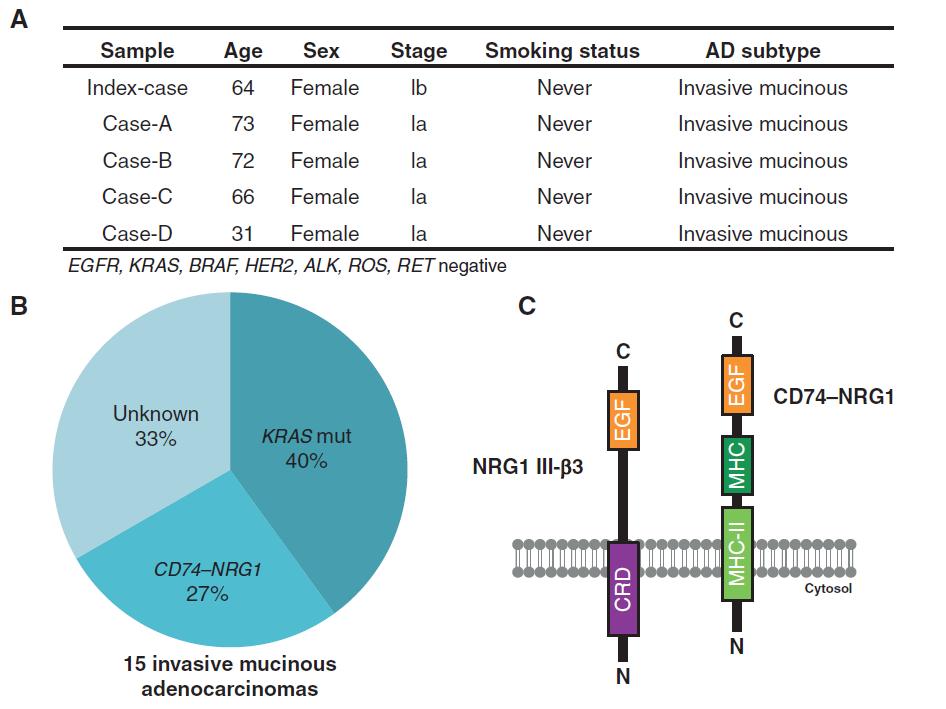 CD74 NRG1 in Mucinous ADC