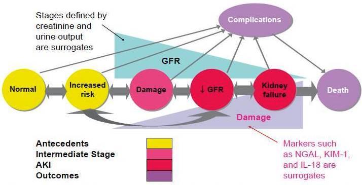 A conceptual model of AKI Preceding stages of increased risk (yellow) Stage where damage occurs but function