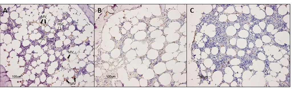 Microscopic photographs of -human bone marrow from control (A), -CLI-diabetes mellitus (DM)+ (B),