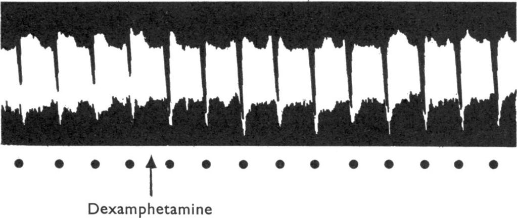 382 A. T. BIRMINGHAM and A. B. WILSON normal tone and pendular movements, a maintained but partial restoration of the inhibitory effects of periarterial nerve stimulation (Fig. 7).