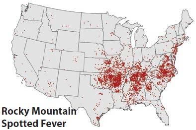 Rocky Mountain Spotted Fever (RMSF) Caused by: Rickettsia rickettsii Vectors: o American dog tick o Rocky Mountain wood tick