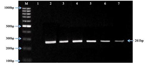 Figure 1. Agarose Gel Electrophoresis of IDH1 PCR Products.