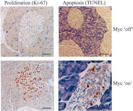 Pelengaris and Khan: Oncogenic co-operation in β-cell tumorigenesis Figure 1 Myc-induced proliferation and apoptosis in pancreatic islets.