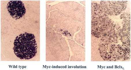 Endocrine-Related Cancer (2001) 8 307 314 Figure 2 Myc-induced islet involution and islet hyperplasia. Immunohistochemical stainingof pancreatic β-cells was performed usingan anti-insulin antibody.