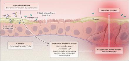 Pathogenesis of Necrotizing Enterocolitis The etiology of NEC has not been definitively identified Compromised epithelial barrier leads to invasion by luminal microbiota leading to inflammation and