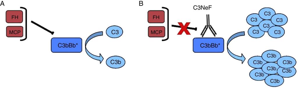 C3 nephritic factor (C3NeF) Existence inferred from the accelerated C3 breakdown in vitro following the addition to normal human serum of serum obtained