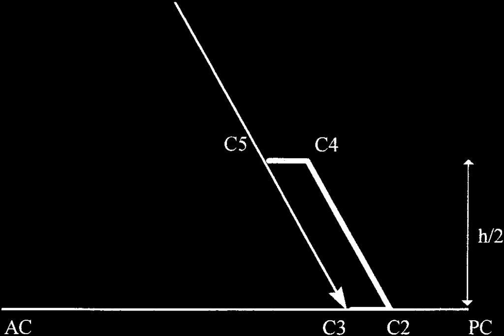 Diagram of the Guiot parallelogram shows the AC-PC plane (the parallelogram is situated at a lateral coordinate of (11.