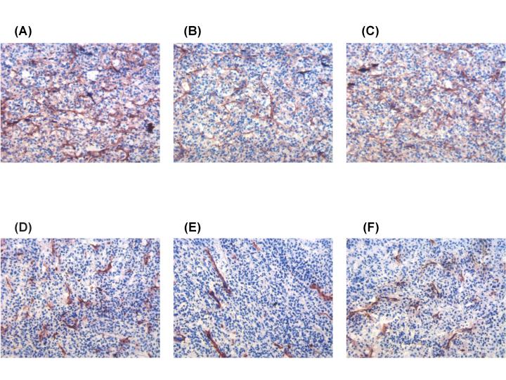 Bose p. 22 of 23. FIG 4. CD31 staining results.