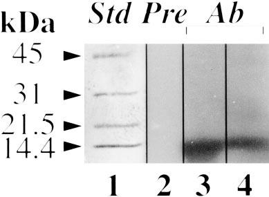 At this time point, the cells were harvested, homogenized, and the cytosol was isolated by ultracentrifugation. The cytosol (2 ml) was applied to a Sephadex G-75 column (1.5 80 cm, 4 C, 0.