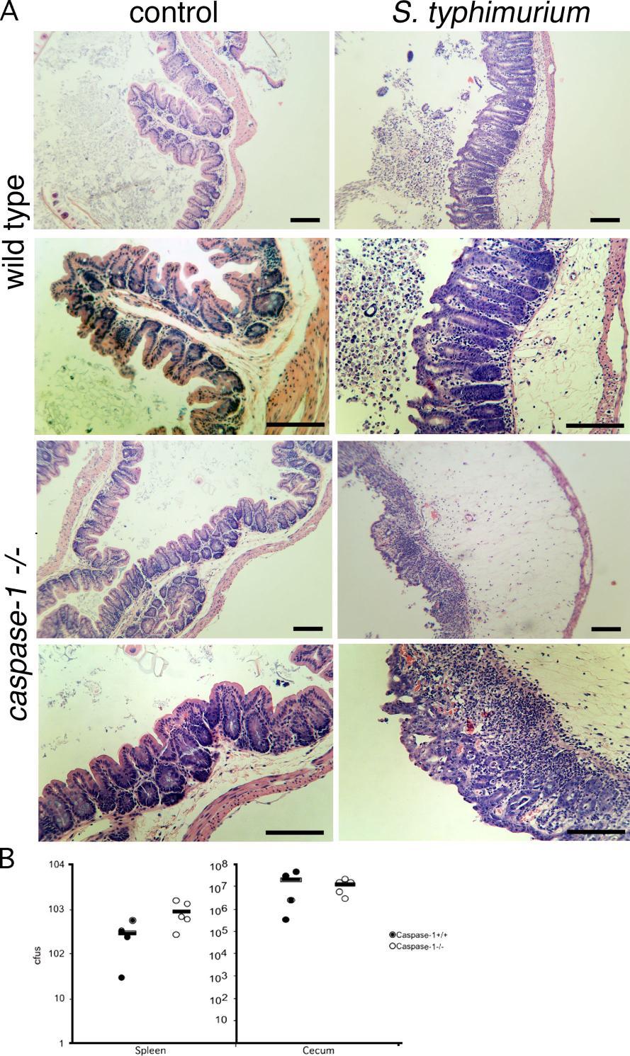 Inflammasome controls a number of common intestinal microbial infections Role of the caspase-1 inflammasome in Salmonella typhimurium