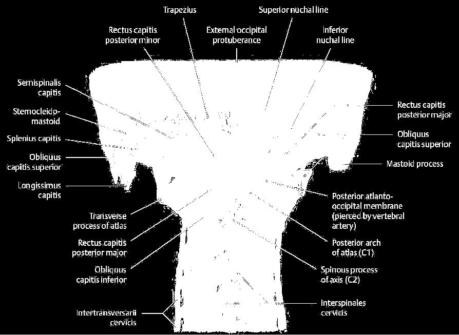 inferior - floor: posterior atlantooccipital