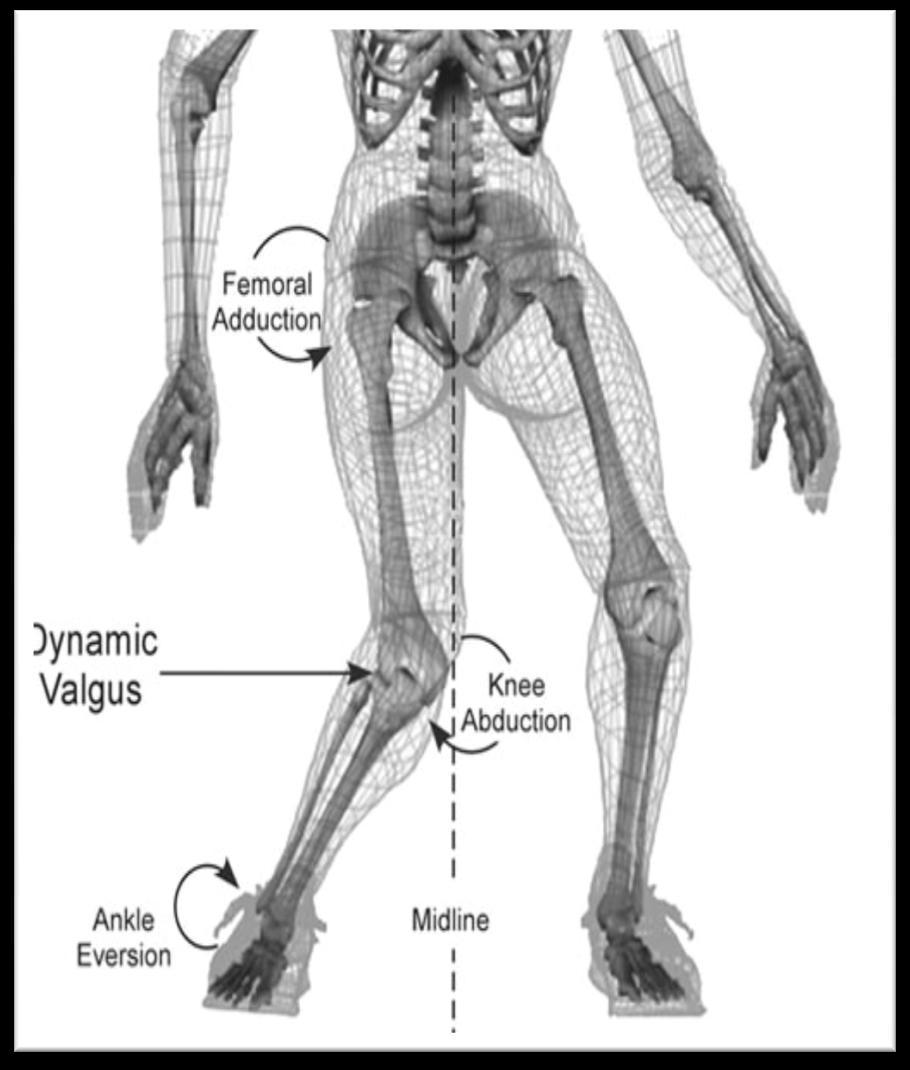 Shin Splints Internal risk factors: Excessive pronation Calf muscle tightness Weakness hip and pelvic musculature Decrease calf endurance External factors: New to running/ sudden