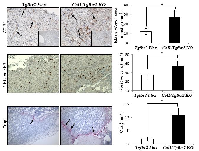 PC3 bone lesion development in LysM/Tgfbr2 KO mice relative to control mice. 2b. LysMcre/Tgfbr2 KO significantly decreased PC3-induced bone lesions (Figure 4). 2c.