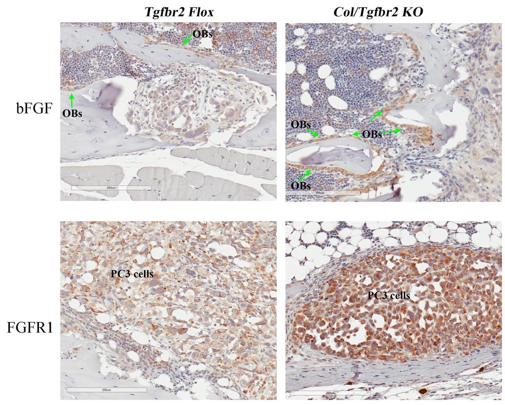 Influence of primary microenvironment on prostate cancer osteoblastic bone lesion development.