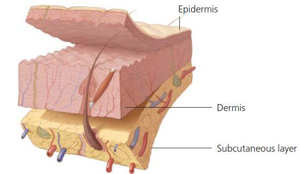 The tissue is then processed using a sodium chloride solution and detergent to remove the epidermis and all viable dermal cells while maintaining the original dermal collagen matrix.