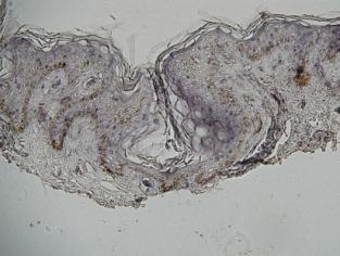 Histological Profile /CGCryoDerm have been processed to remove cells while maintaining histomorphological