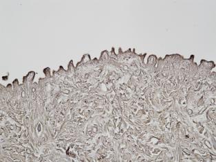 Standard histology and immunohistochemical methods have been used to assess the dermal matrix structure