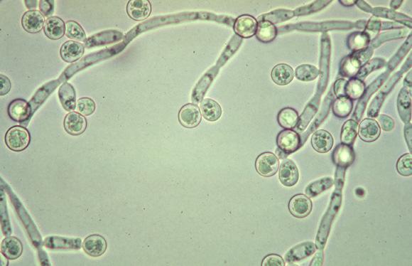 Chlamydospores of C.albicans Vulvovaginitis of children The vagina is close to the anus and the vulva lacks the protective labial fat and pubic hair of an adult.