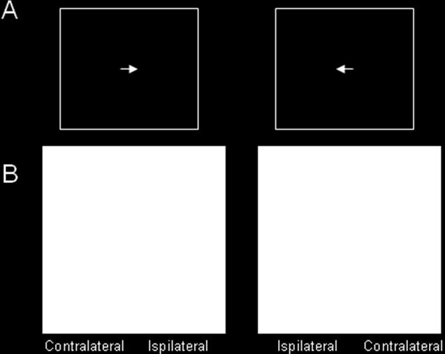 Figure 3. Diagram illustrating the contralateral control method.