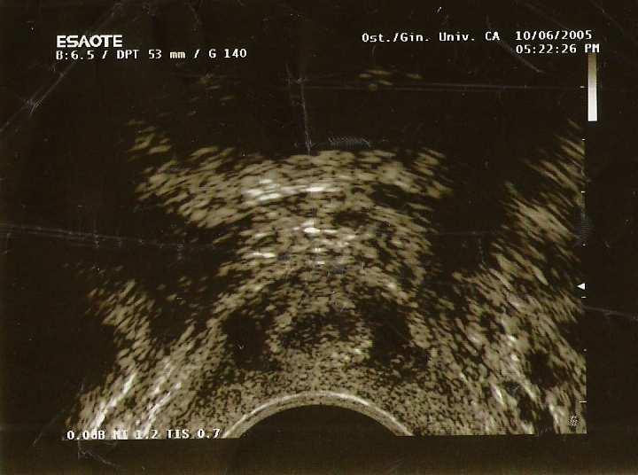Ultrasound in urogynaecology Urethral