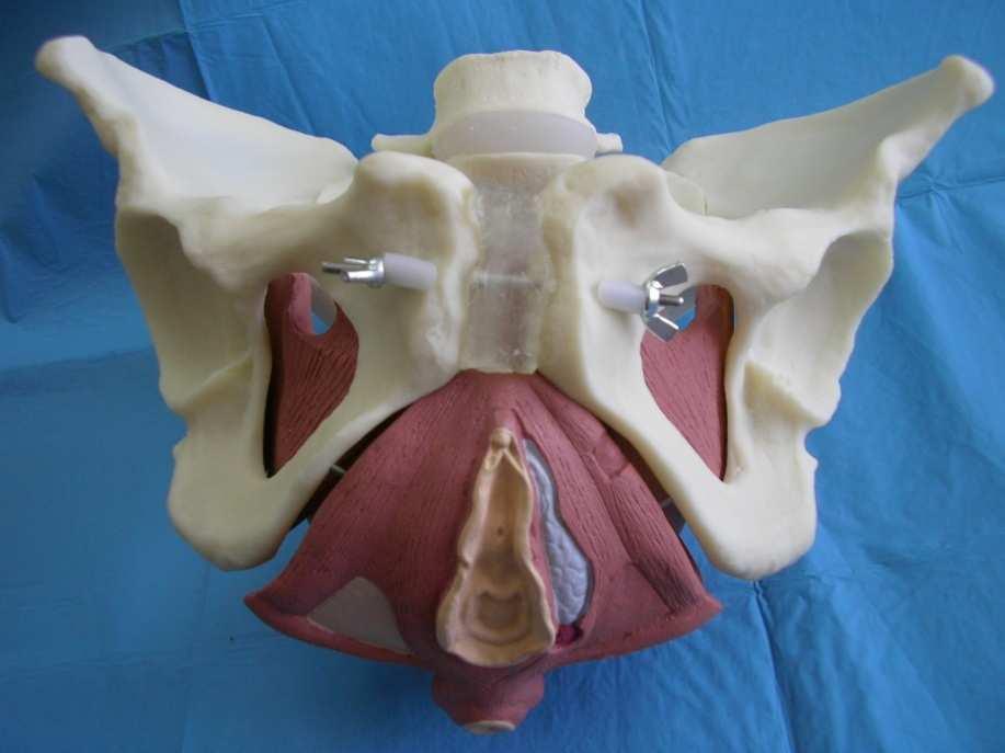 Pelvic floor composition peritoneum viscera endopelvic fascia