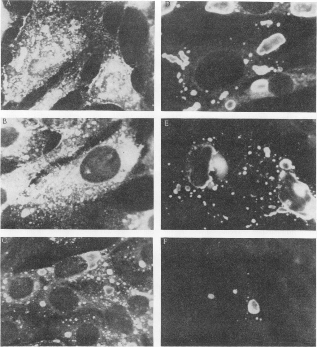 VOL. 6,1972 CHRONIC RABIES VIRUS INFECTION OF CELL CULTURES 991 FIG. 2. Fluorescent-antibody staining of rabies virus-infected (Pasteur straini) Nil-2 cells.