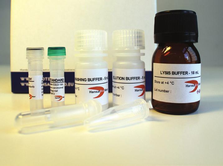 Extracellular Vesicle RNA extraction kits Ordering information Products can be purchased directly in our on-line shop: www.exotest.eu/online_orders/ Distributors: www.hansabiomed.eu/index.