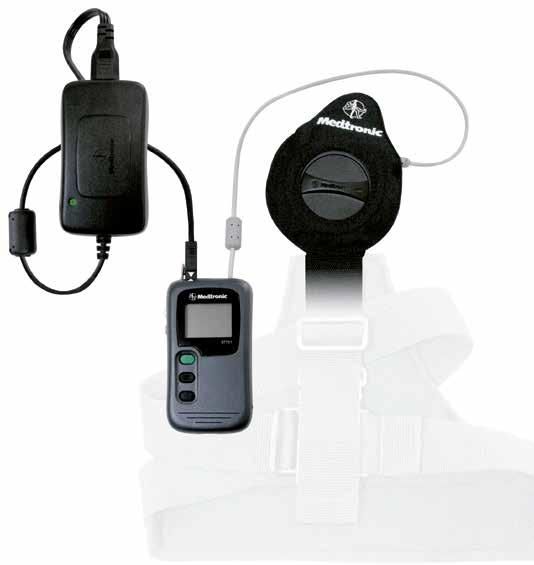 CHARGING SYSTEM FOR ACTIVA DBS THERAPY QUICK GUIDE Charger for Activa DBS Therapy from Medtronic, Inc.