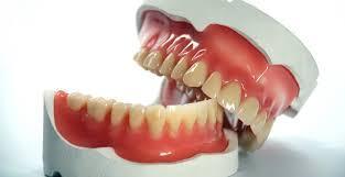 Prosthesis In the dental field,