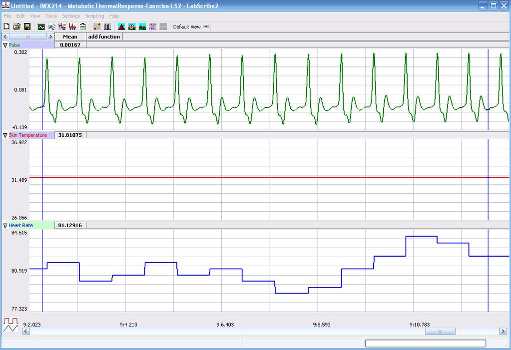 Figure HE-1-L3: Pulse, skin temperature, and heart rate recordings while subject is at rest, displayed in the Analysis window. 7.