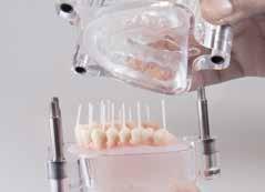 - How to obtain an implant denture with composite teeth or/and gingiva.