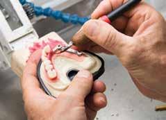 - How to obtain a permanent implant denture starting from the immediate loading framework.