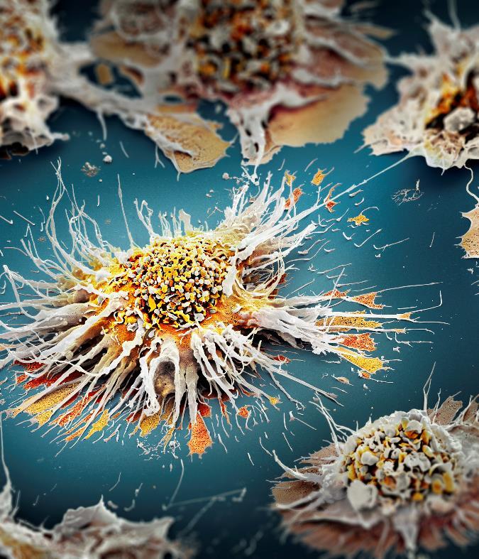 Conclusions LAMP-Vax and Cancer Immunotherapy LAMP-Vax Nucleic Acid Vaccine Platform: Fulfills an Unmet Need in Cancer Immunotherapy Could activate Th1 Type Tumor Specific T cell responses at the