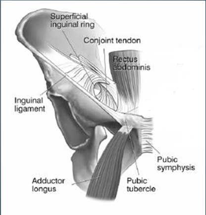 Intraarticular hip problem Impingement Labral tear Femoral neck stress fracture Extraarticular hip problem Hip flexor strain Sports hernia GI/gyn problems Falvey EC et al, BJSM. 2007. 1.
