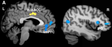 Prefrontal cortex vmpfc activity Hayes et al.