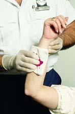 Control of bleeding Direct pressure Apply sterile dressing to wound Compress bleeding vessels 28