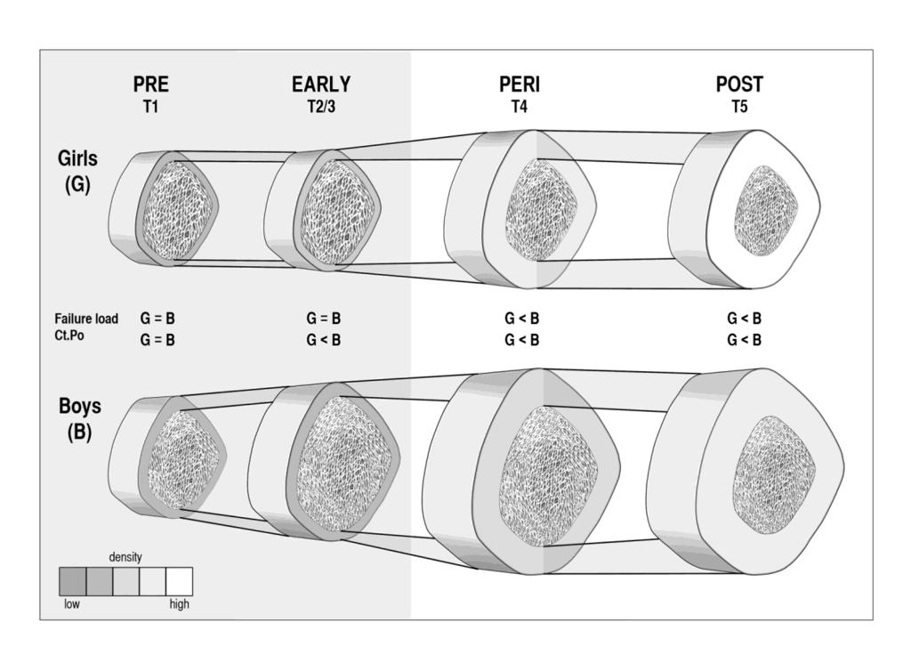 Figure 4.5: A schematic representation of differences in total bone size and cortical bone density for girls (G) and boys (B) across puberty (assessed using the method of Tanner (T)).