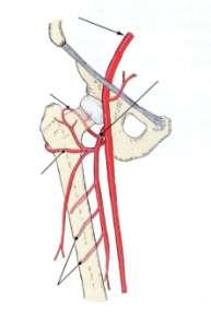 *Femoral artery passes through Subsartorial canal or Adductor canal which ends at the Adductor opening.